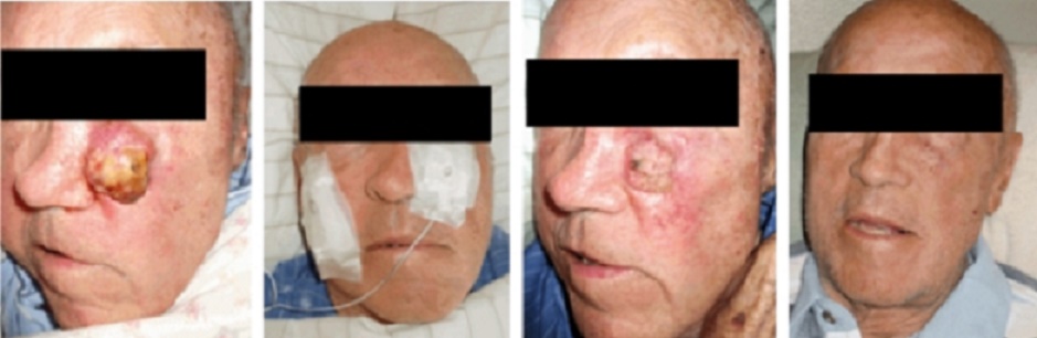 फ्लोरिडा, अमेरिका का एक रोगी