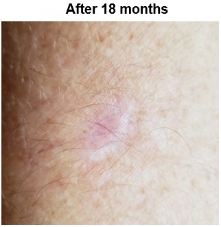 Alabama man - August 2025